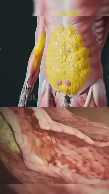 LIVER CLEANSE & DETOX -Limpieza Natural para Desintoxicar y Proteger el Hígado